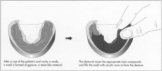 Artificial Dentures and Allied Items